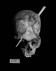 The trajectory of a bullet through the skull. These remains were exhumed from the grounds of a convent in Joyabaj which was occupied by the Guatemalan army in the 1980s and used as a garrison, torture center, and clandestine cemetery. Santa Cruz del Quiché, 2000